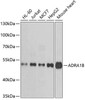 Cell Biology Antibodies 11 Anti-ADRA1B Antibody CAB7872