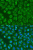 Metabolism Antibodies 2 Anti-EIF2B1 Antibody CAB7892