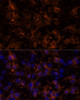 Cell Biology Antibodies 11 Anti-NCAM1 / CD56 Antibody CAB7913