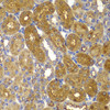 Metabolism Antibodies 2 Anti-AMPKBeta1 Antibody CAB7921