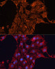 Cell Biology Antibodies 11 Anti-ADAM12 Antibody CAB7940