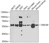 Epigenetics and Nuclear Signaling Antibodies 4 Anti-TERF2IP Antibody CAB7981