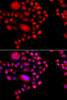 Cell Biology Antibodies 11 Anti-POLR1D Antibody CAB8021