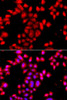 Epigenetics and Nuclear Signaling Antibodies 4 Anti-OSGEPL1 Antibody CAB8022