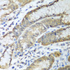 Cell Biology Antibodies 11 Anti-ADH1C Antibody CAB8081