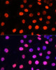 Cell Biology Antibodies 11 Anti-MonoMethyl-NONO-R357/R365 Antibody CAB8087