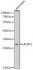 Cell Biology Antibodies 11 Anti-ACRV1 Antibody CAB8098