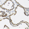 Cell Biology Antibodies 11 Anti-CALCB Antibody CAB8105