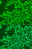 Cell Biology Antibodies 11 Anti-Cystatin-M Antibody CAB8115