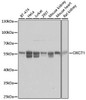 KO Validated Antibodies 1 Anti-OXCT1 Antibody CAB8139KO Validated