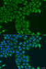 Developmental Biology Anti-CDK16 Antibody CAB8140