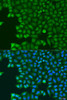 Immunology Antibodies 3 Anti-ABCE1 Antibody CAB8146