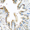 Cell Biology Antibodies 12 Anti-BCKDK Antibody CAB8184