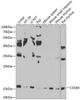 Immunology Antibodies 3 Anti-CD160 antigen Antibody CAB8189