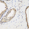 Cell Biology Antibodies 12 Anti-METTL7A Antibody CAB8201