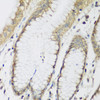 Cell Biology Antibodies 12 Anti-METTL7A Antibody CAB8201
