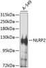 Cell Death Antibodies 2 Anti-NLRP2 Antibody CAB8233