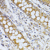 Cell Biology Antibodies 12 Anti-CCDC92 Antibody CAB8262