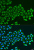 Cell Biology Antibodies 12 Anti-PDGFD Antibody CAB8263