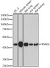 Immunology Antibodies 3 Anti-RSAD2 Antibody CAB8271
