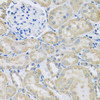 Epigenetics and Nuclear Signaling Antibodies 4 Anti-DCP2 Antibody CAB8282