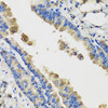 Immunology Antibodies 3 Anti-IL36G Antibody CAB8304
