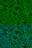Cell Biology Antibodies 12 Anti-Ribonuclease 3 Antibody CAB8336