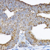 Cell Biology Antibodies 12 Anti-GRPEL2 Antibody CAB8339