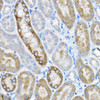 Cell Biology Antibodies 12 Anti-GRPEL2 Antibody CAB8339