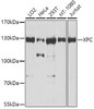 Epigenetics and Nuclear Signaling Antibodies 4 Anti-XPC Antibody CAB8354