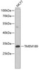 Metabolism Antibodies 3 Anti-TMEM189 Antibody CAB8380