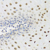 Cell Biology Antibodies 12 Anti-YTHDF3 Antibody CAB8395