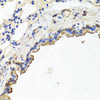 Cell Biology Antibodies 12 Anti-TUBB8 Antibody CAB8396