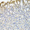 Cell Biology Antibodies 12 Anti-TUBB8 Antibody CAB8396