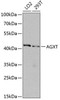 Cell Biology Antibodies 12 Anti-AGXT Antibody CAB8397