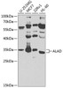 Metabolism Antibodies 3 Anti-ALAD Antibody CAB8398