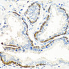 Cell Biology Antibodies 12 Anti-BMP5 Antibody CAB8401