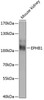 Cell Biology Antibodies 12 Anti-EPHB1 Antibody CAB8415