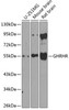 Cell Biology Antibodies 12 Anti-GHRHR Antibody CAB8421