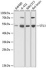 Cell Biology Antibodies 12 Anti-ST13 Antibody CAB8454