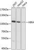 Epigenetics and Nuclear Signaling Antibodies 4 Anti-Protein HIRA Antibody CAB8461