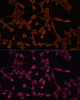 Signal Transduction Antibodies 3 Anti-ABCB11 Antibody CAB8467