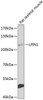 Metabolism Antibodies 3 Anti-LPIN1 Antibody CAB8486