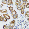 Cell Biology Antibodies 12 Anti-RIPK4 Antibody CAB8495