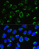 Signal Transduction Antibodies 3 Anti-PTCD3 Antibody CAB8497