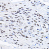 Cell Biology Antibodies 12 Anti-SMEK1 Antibody CAB8500