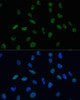 Epigenetics and Nuclear Signaling Antibodies 4 Anti-MKL1 Antibody CAB8504