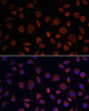 Autophagy Antibodies Anti-ULk1 Antibody CAB8529