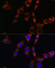 Signal Transduction Antibodies 3 Anti-Aquaporin-8 Antibody CAB8539