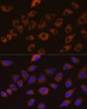 Immunology Antibodies 3 Anti-DLG1 Antibody CAB8542